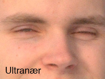 ultranaer